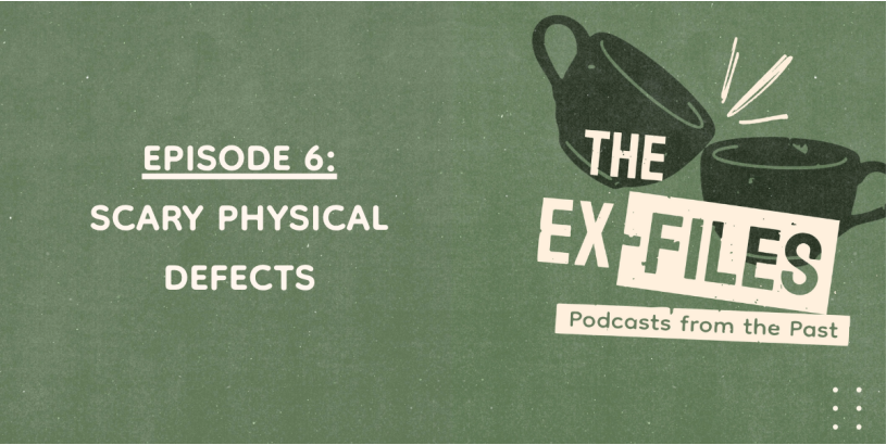 The Ex-Files | Scary Physical Defects Ep. 6
